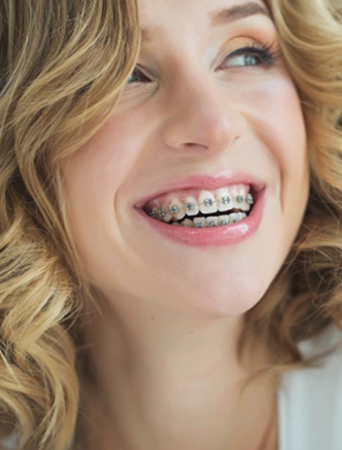 a patient happy with cost of traditional braces in Tucson