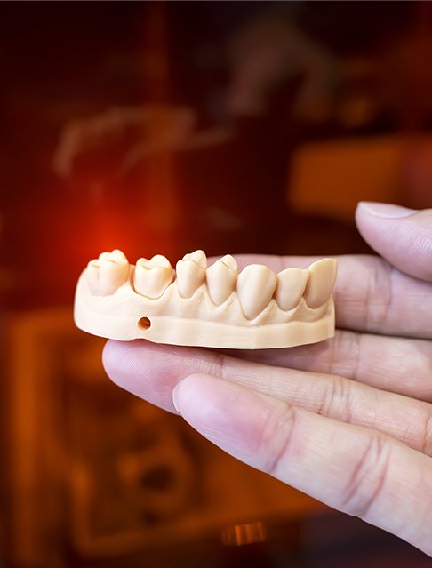 3 D printed smile model