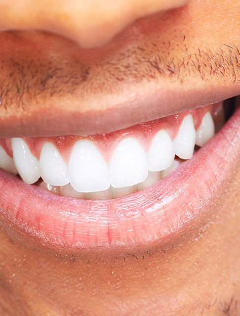 Closeup of a man smiling