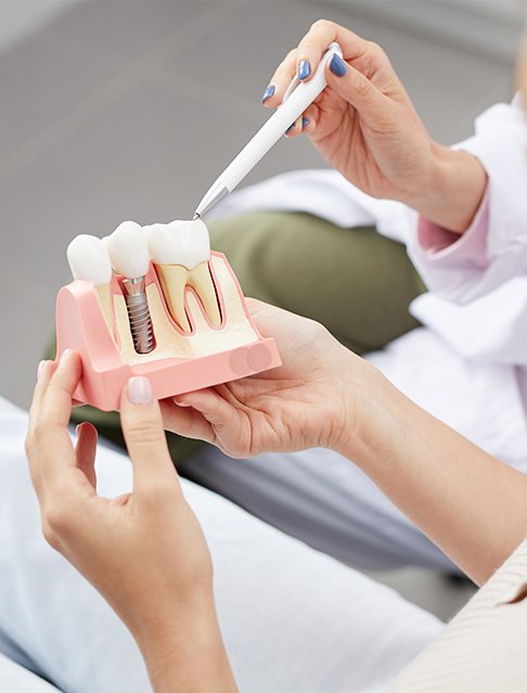 Dentist showing patient dental implant supported dental crown model