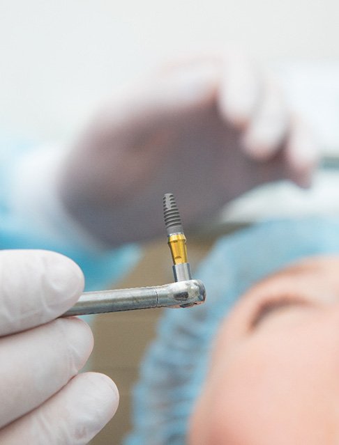 Dentist about to place dental implant in patient’s mouth