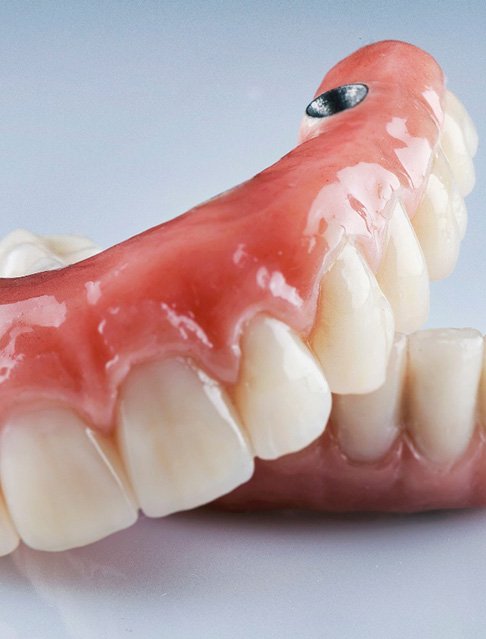Closeup of a set of implant dentures on slightly reflective surface
