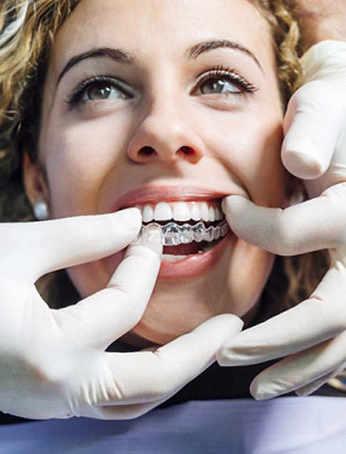 woman getting Invisalign in Marana