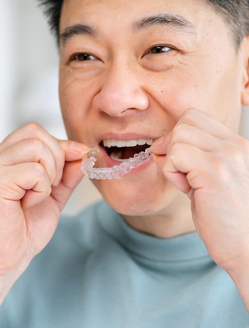 man putting on Spark Clear Aligner