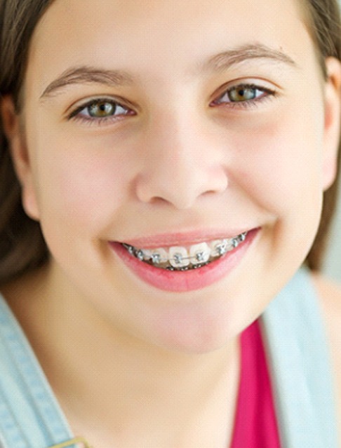 Girl smiling with braces in Marana
