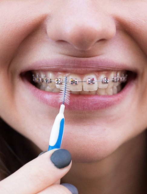 Girl using interdental brush in Marana