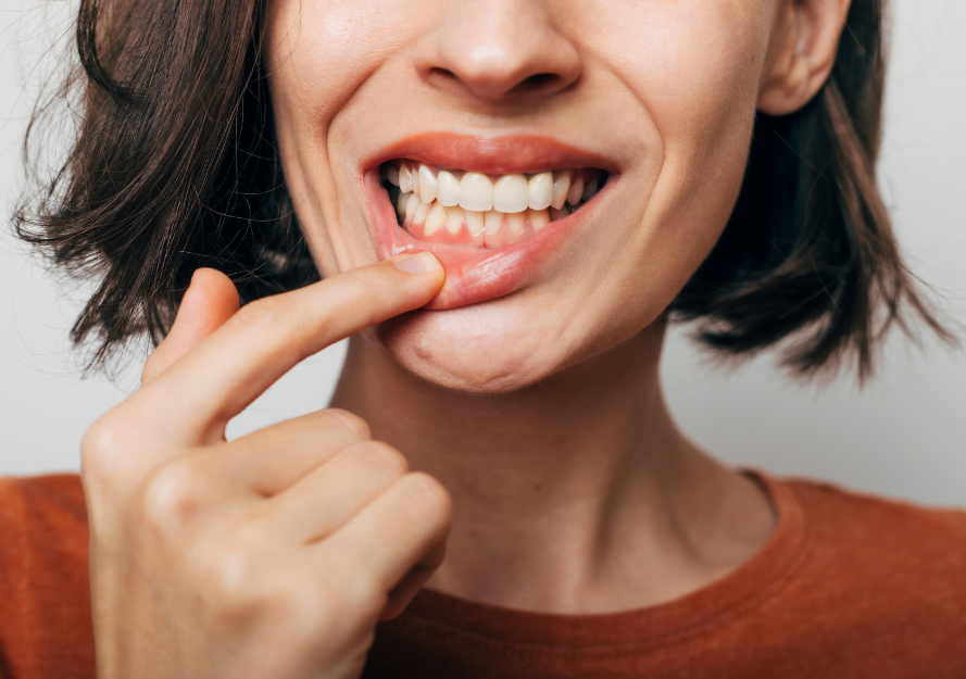 Woman showing gums